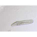 Paramecium Caudatum